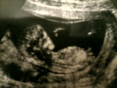 Bild zu babyfoto - Forum für Juni - Mamis