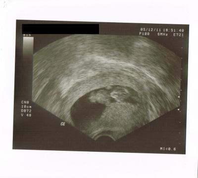 Bild zu Ebenfalls zurück vom FA =) - Forum für Juni - Mamis