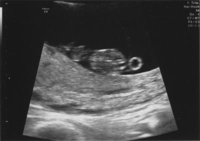 Bild zu Wieder da... - Forum für Juni - Mamis