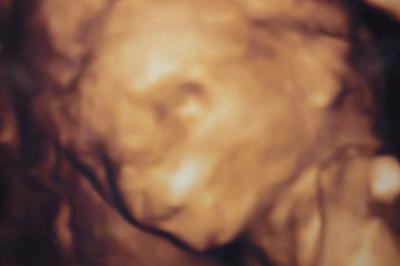 Bild zu Foto von unserem kleinen lächelnden Mann (15 ssw) :-) - Forum für Juni - Mamis
