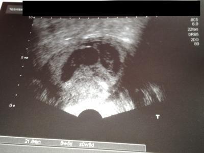 Bild zu Geschafft,Zwillings Fotos - Forum für Juni - Mamis