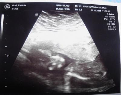 Bild zu Bericht von meinen FA Besuch gestern :-) - Forum für Juni - Mamis