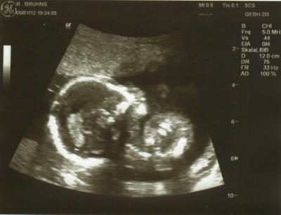 Bild zu Auch zurück vom FA - Forum für Juni - Mamis