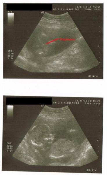 Bild zu Gestern FA-Termin mit Outing :) - Forum für Juni - Mamis