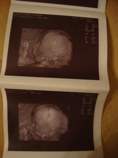 Bild zu FA und endlich Outing und 3D-Bild :-) - Forum für Juni - Mamis