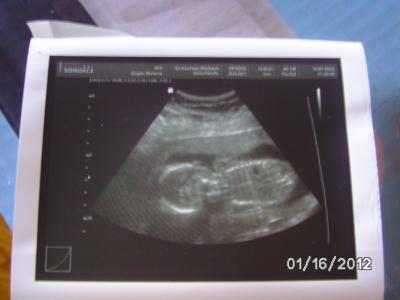 Bild zu Heute FA Termin gehabt mit Outing ich ich könnte die ganze Welt knutschen:-) - Forum für Juni - Mamis