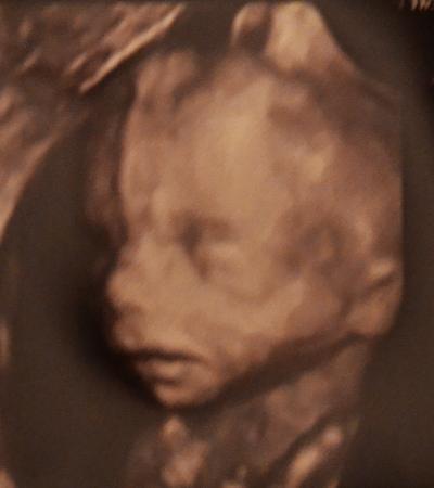 Bild zu Gesern beim FA (inkl. 4D-Bildchen) - Forum für Juni - Mamis