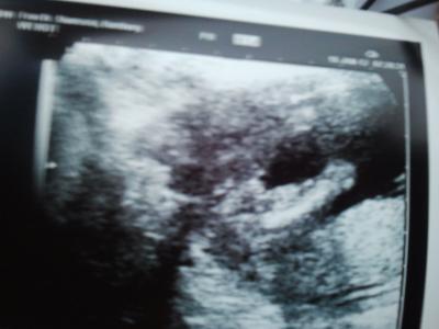 Bild zu outing rate Bild - Forum für Juni - Mamis