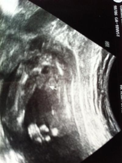 Bild zu Habe auch ein Rate Bild :))) - Forum für Juni - Mamis