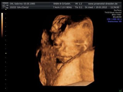 Bild zu Bericht von der Feindiaknostig - Forum für Juni - Mamis