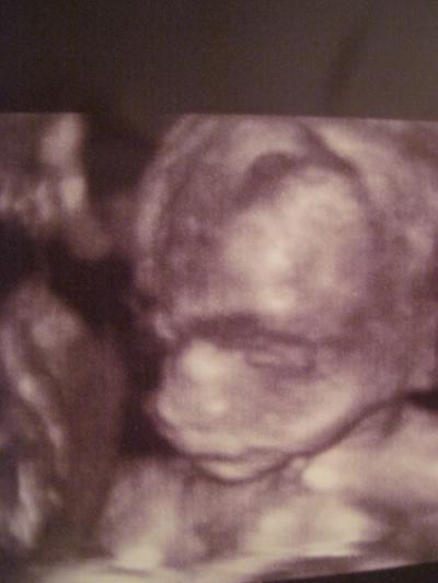 Bild zu mal kurzer Bericht von der VU mit Organscreening heute... - Forum für Juni - Mamis