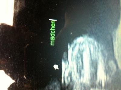 Bild zu Zurück vom Feinultraschall und Outing Foto - Forum für Juni - Mamis