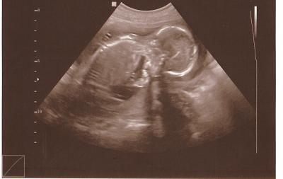 Bild zu Nachtrag zum FA Bericht von letztem Donnerstag - Forum für Juni - Mamis