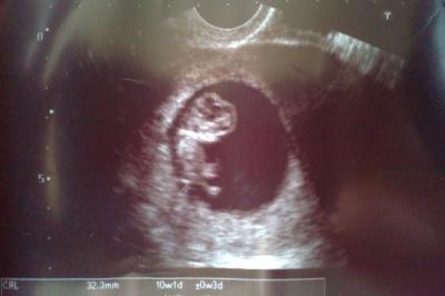 Bild zu Wie und wann habt ihr erfahren das ihr ss seit??? - Forum für Juni - Mamis