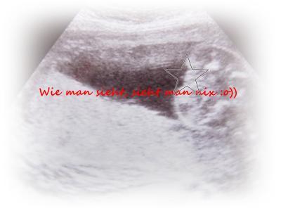 Bild zu ♥♥Outing♥♥ Ein wunderschönes Screening heute :o)) - Forum für Juni - Mamis