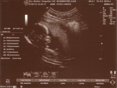 Bild zu Foto unseres Prinzen - Forum für Juni - Mamis