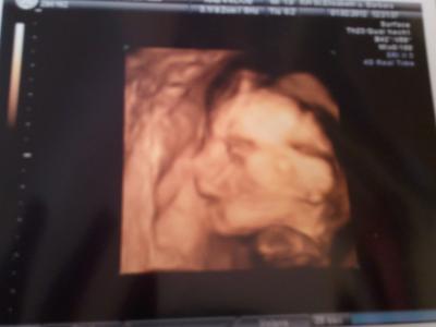 Bild zu Zurück von der FD mit foto - Forum für Juni - Mamis