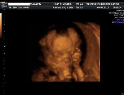 Bild zu Einfach nur zum verlieben:)) - Forum für Juni - Mamis