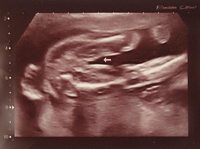 Bild zu Frage an die Mamis mit Mädel-Outing - Forum für Juni - Mamis