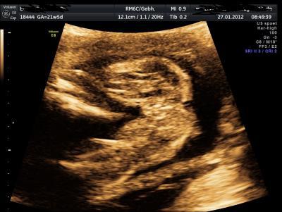 Bild zu Was meint Ihr? - Forum für Juni - Mamis