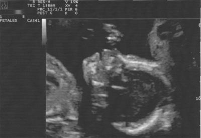 Bild zu Bild von der VU gestern - Forum für Juni - Mamis