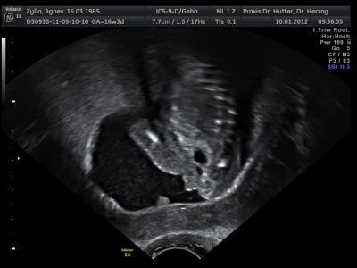 Bild zu outing - Forum für Juni - Mamis