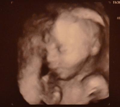 Bild zu Su, und hier noch die Bilder von gestern! ;) - Forum für Juni - Mamis