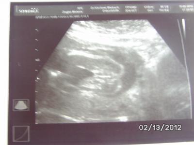 Bild zu Wieder zurück von der VU freue mich so  (mit Bild) - Forum für Juni - Mamis