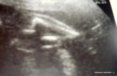 Bild zu war heute beim FA und habe ein Bild mitgebracht - Forum für Juni - Mamis