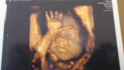 Bild zu Pupsi in 3d!! - Forum für Juni - Mamis