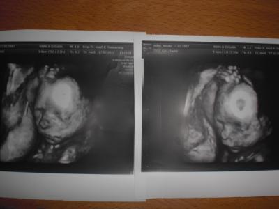 Bild zu Wie ist das bei euch?! - Forum für Juni - Mamis