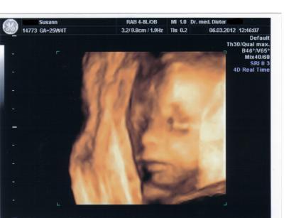 Bild zu Bericht + Bilder vom 3 D - Forum für Juni - Mamis