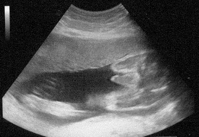 Bild zu Gestern endlich Outing! - Forum für Juni - Mamis