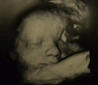 Bild zu Neues aus dem Bauch (natürlich mit Bildchen)! - Forum für Juni - Mamis