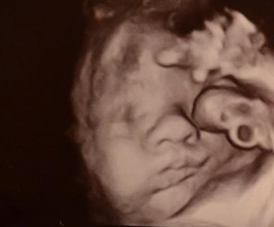 Bild zu Gestern beim FA! ;) - Forum für Juni - Mamis