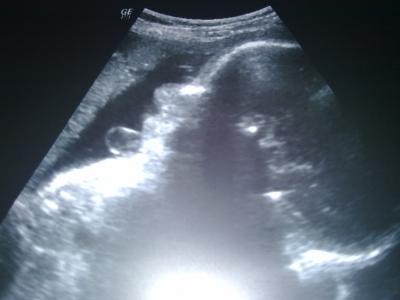 Bild zu Zurück vom FA - Forum für Juni - Mamis