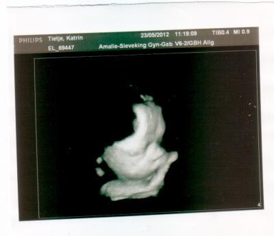 Bild zu Bilder vom gestrigen KH Termin! - Forum für Juni - Mamis