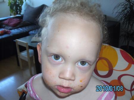 Bild zu 