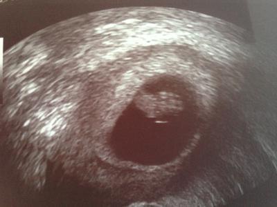 Bild zu Zurück vom FA mit Mutterpass und Foto von 8+0 :-) - Forum für Juni - Mamis