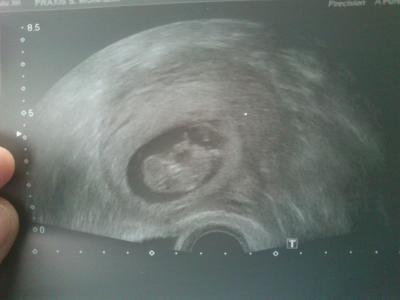 Bild zu gestern beim fa gewesen - Forum für Juni - Mamis