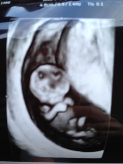 Bild zu 4D Ultraschall ich bin so begeistert - Forum für Juni - Mamis