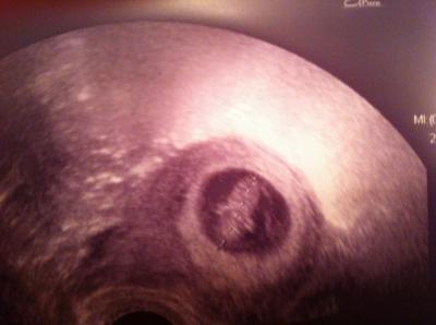 Bild zu Und hier unser Foto - Forum für Juni - Mamis