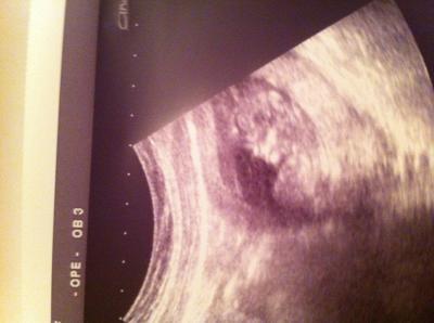 Bild zu Fa Bericht +Foto - Forum für Juni - Mamis