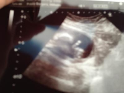 Bild zu Vallentinstags FD mit Fotobeweis :) - Forum für Juni - Mamis