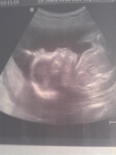 Bild zu Ultraschallbild 23 ssw - Forum für Juni - Mamis