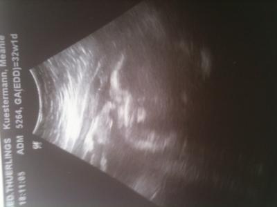 Bild zu Gestern Fa Termin mit lustigen us Bild !!!! - Forum für Juni - Mamis