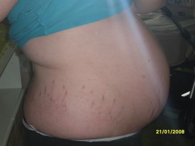 Bild zu Bauchbilder! - Forum für Juni - Mamis