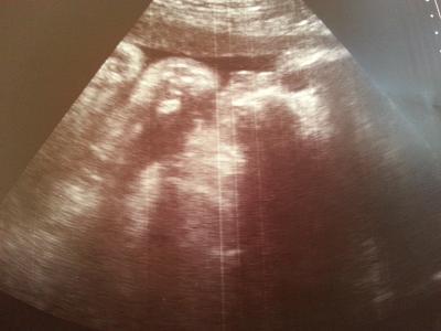 Bild zu Heute Termin gehabt! Größe Gewicht und Bild anbei! - Forum für Juni - Mamis