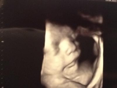 Bild zu Bericht Gyn und 3D - Forum für Juni - Mamis