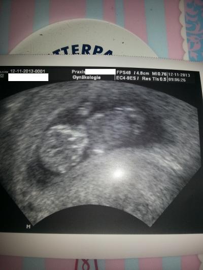 Bild zu Unser Baby < 3 - Forum für Juni - Mamis